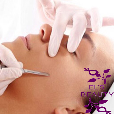 elsbeauty dermaplaning